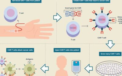 CAR T-Cell Therapy Emerges in Multiple Myeloma