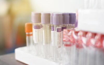 Genetic Test Identifies Ultra-High-Risk Myeloma Patients