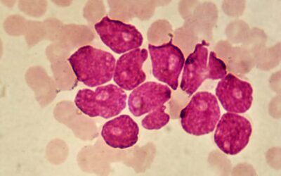 Blood cancer more likely to affect relatives of people who have it, study shows