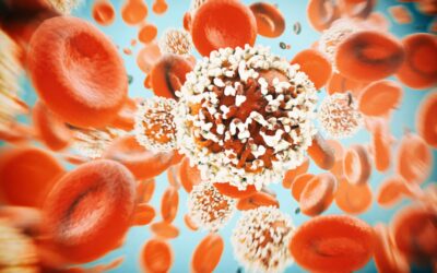 Study Identifies Independent Predictors of Smoldering Multiple Myeloma Progression