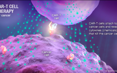 CAR T-Cell Therapies Show Promise for Multiple Myeloma, but Hurdles Remain